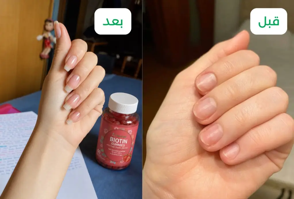 أظافر قبل وبعد
